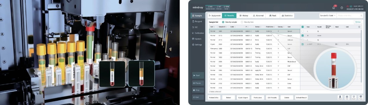 M1000 Chemistry and Immunoassay Integrated Solution for Large-Scale Laboratories