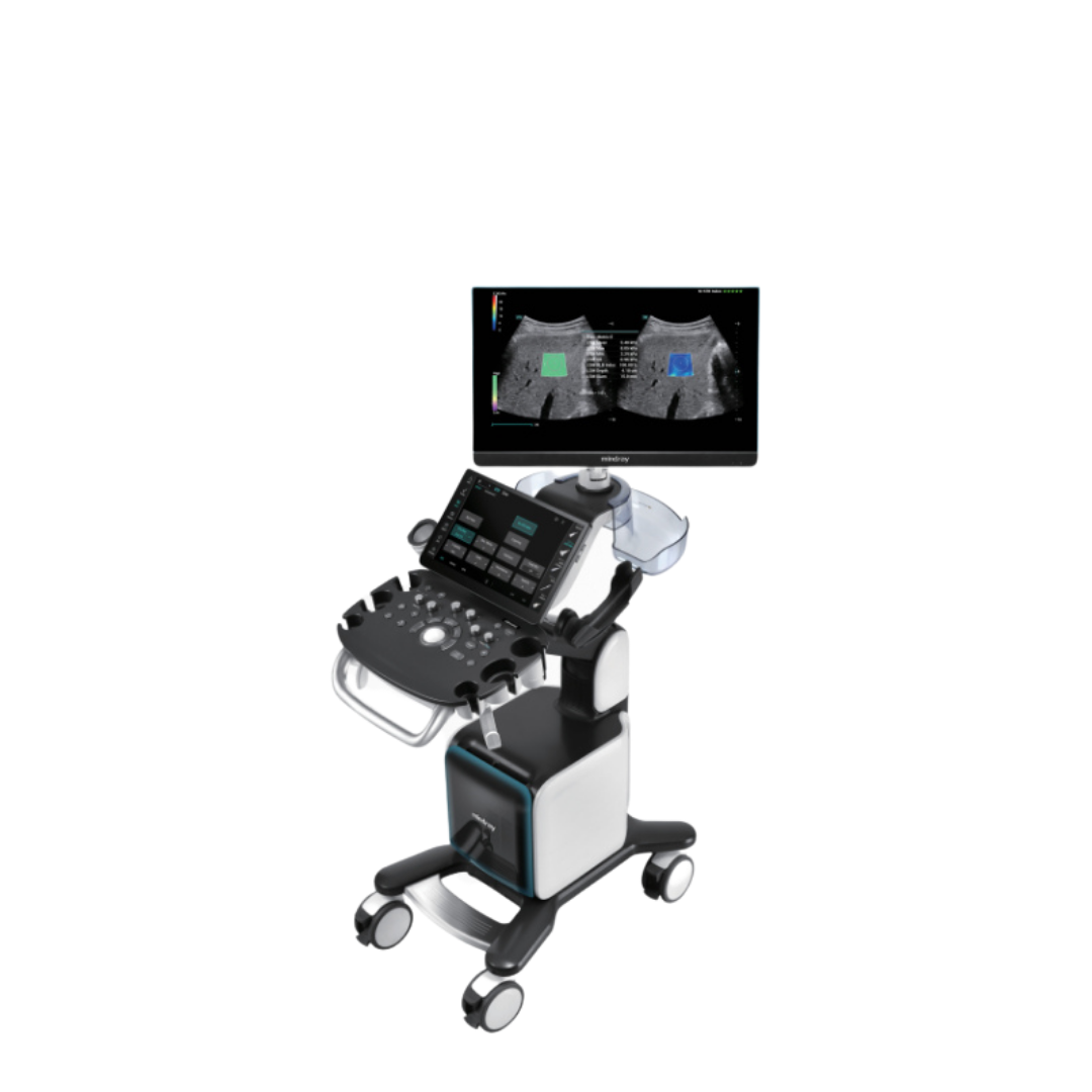 Consona N9 Comprehensive Ultrasound Imaging System