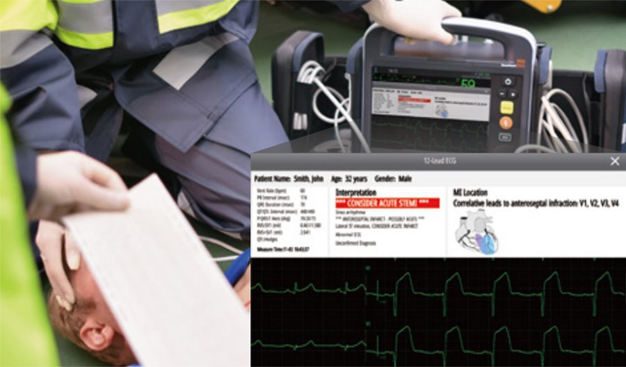 Mindray BeneHeart D60 Defibrillator Monitor with Smart Touch Technology and Point-of-Care Ultrasound