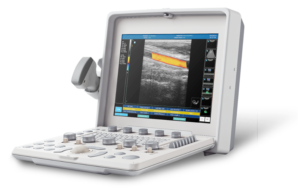 Color Doppler Ultrasound NEUCU36
