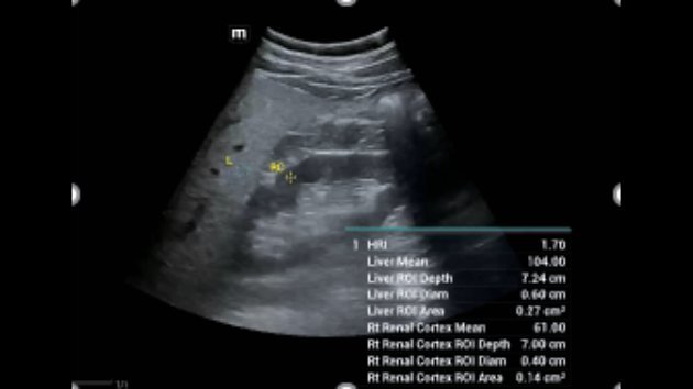 Consona N8 Diagnostic Ultrasound System - Advanced Imaging Solutions for Healthcare Professionals