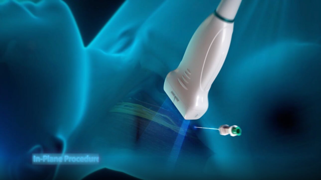 Mindray TE7 ACE Ultrasound Machine for Anesthesia, Critical Care, and Emergency Applications