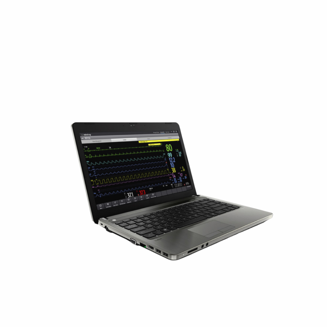 BeneVision CMS Viewer - Remote Patient Data Access and Clinical Workflow Optimization Tool