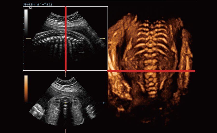Nuewa R9 Platinum Edition Women's Healthcare Ultrasound System with Ultra-Micro Angiography Technology