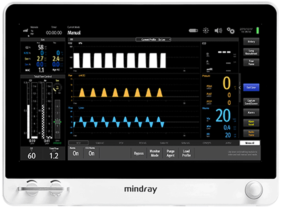 "A8 Anesthesia System - Advanced Safety and Efficiency Features for Surgical Settings"