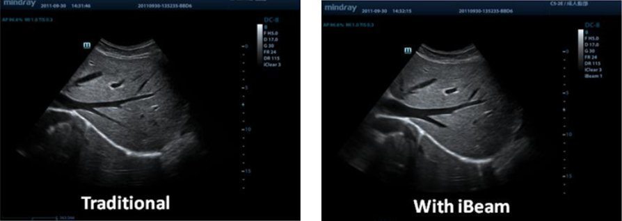 Mindray M9 Ultrasound System - Premium Imaging with Advanced Transducer Technology