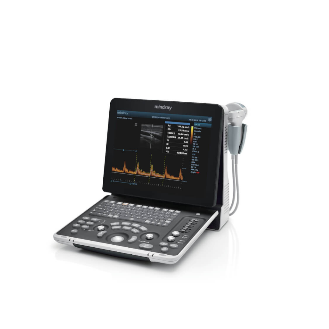 DP-50Exp Portable Ultrasound System with PW Doppler and 3D/4D Imaging