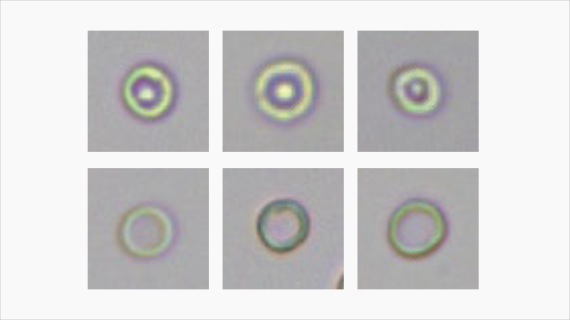 Fully Automated Urinalysis System EU 8600/EU 8600 GT with Advanced Imaging and Modular Design