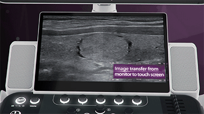 Mindray DC-80A Diagnostic Ultrasound System with X-Insight Technology