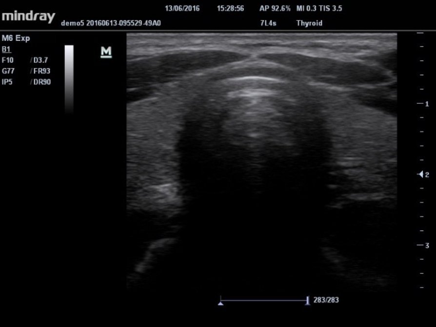 Mindray M6 Ultrasound System - Compact, Portable, and High-Performance Diagnostic Tool
