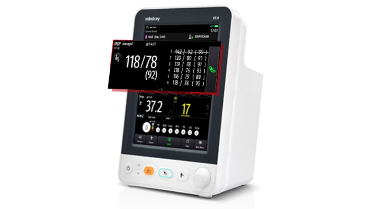 VS 8 Vital Signs Monitor: Advanced Patient Monitoring Solution for Accurate Vital Measurements