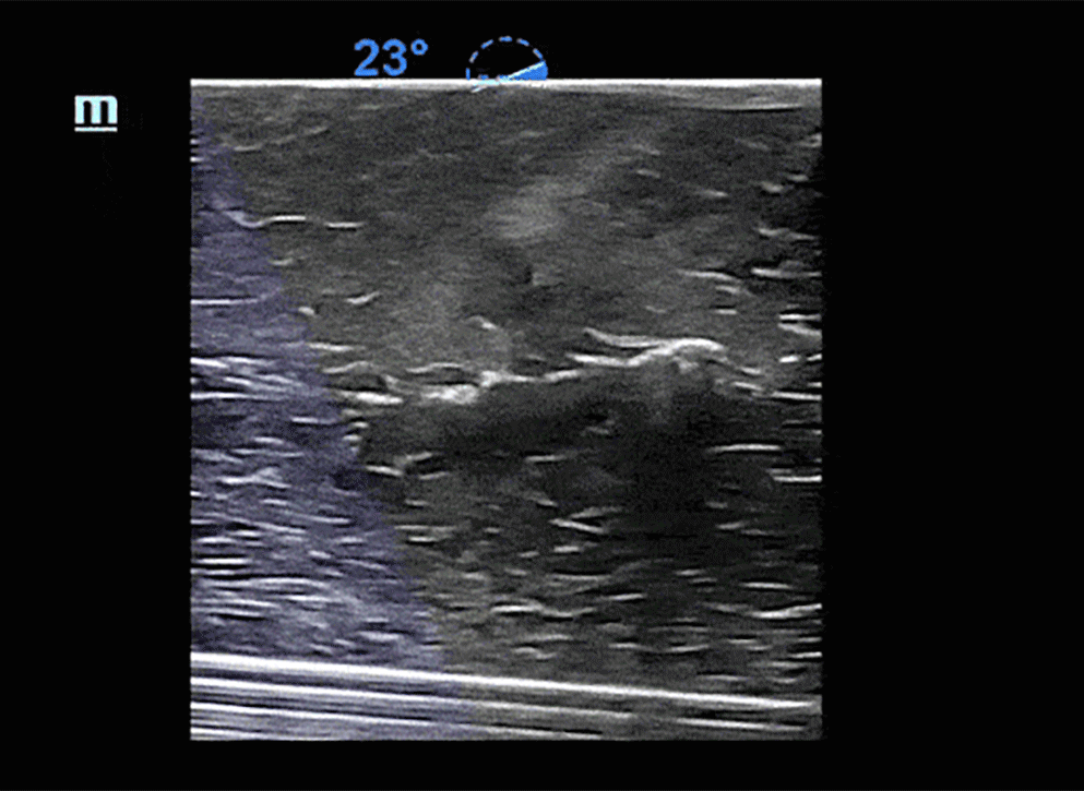 Mindray TE7 ACE Ultrasound Machine for Anesthesia, Critical Care, and Emergency Applications