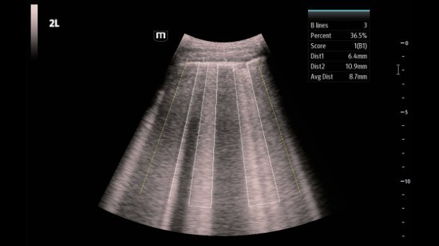 Consona N9 Comprehensive Ultrasound Imaging System
