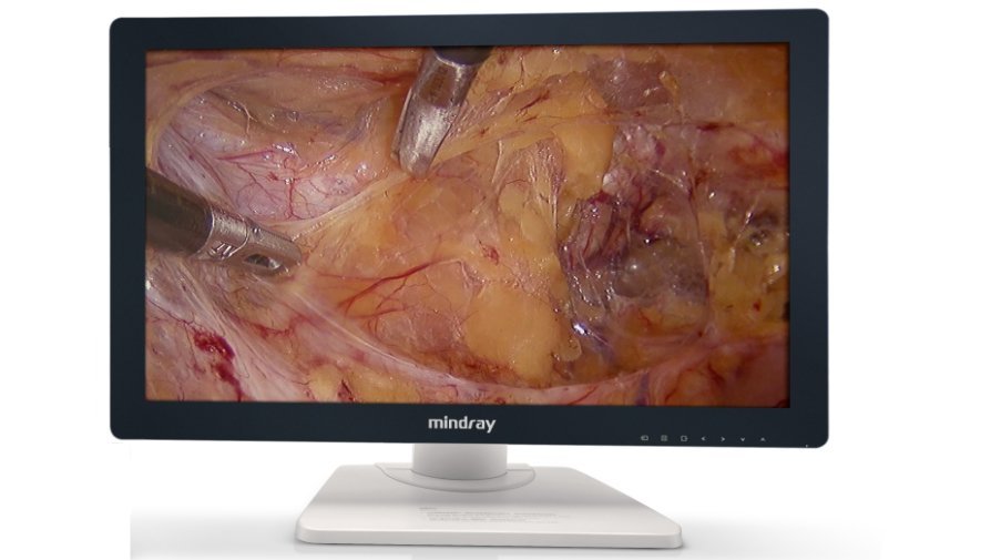 Mindray HD3 Endoscope Camera System | 3-Chip CMOS, FHD Imaging, Advanced Parfocal Technology