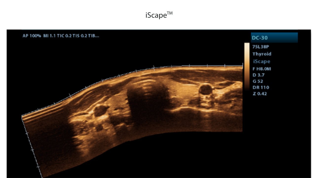 DC-30 FullHD Ultrasound System for Enhanced Diagnostic Imaging