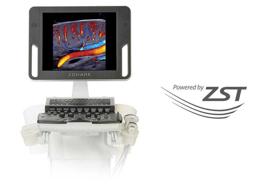 Z.One PRO Ultrasound System - Advanced Imaging Technology with ZONE Sonography®
