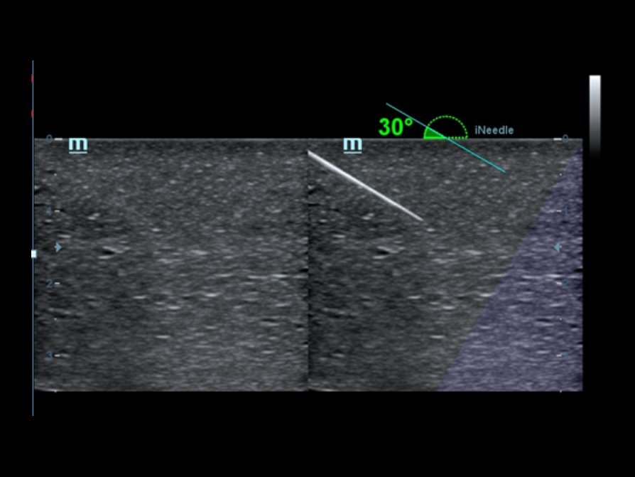 Mindray M6 Ultrasound System - Compact, Portable, and High-Performance Diagnostic Tool