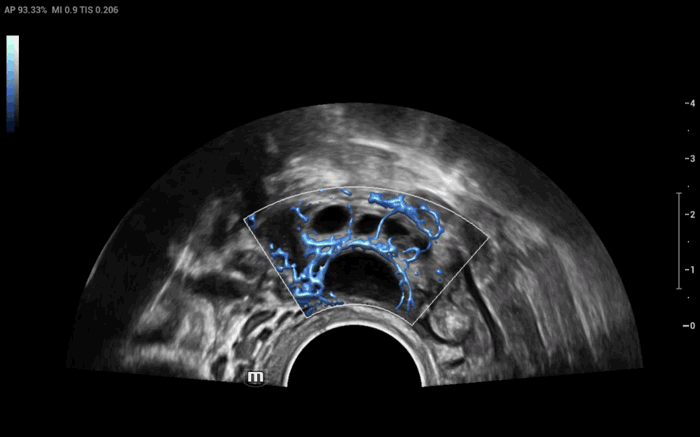Nuewa I9 Elite Edition - Advanced Diagnostic Ultrasound System for Women and Neonatal Healthcare
