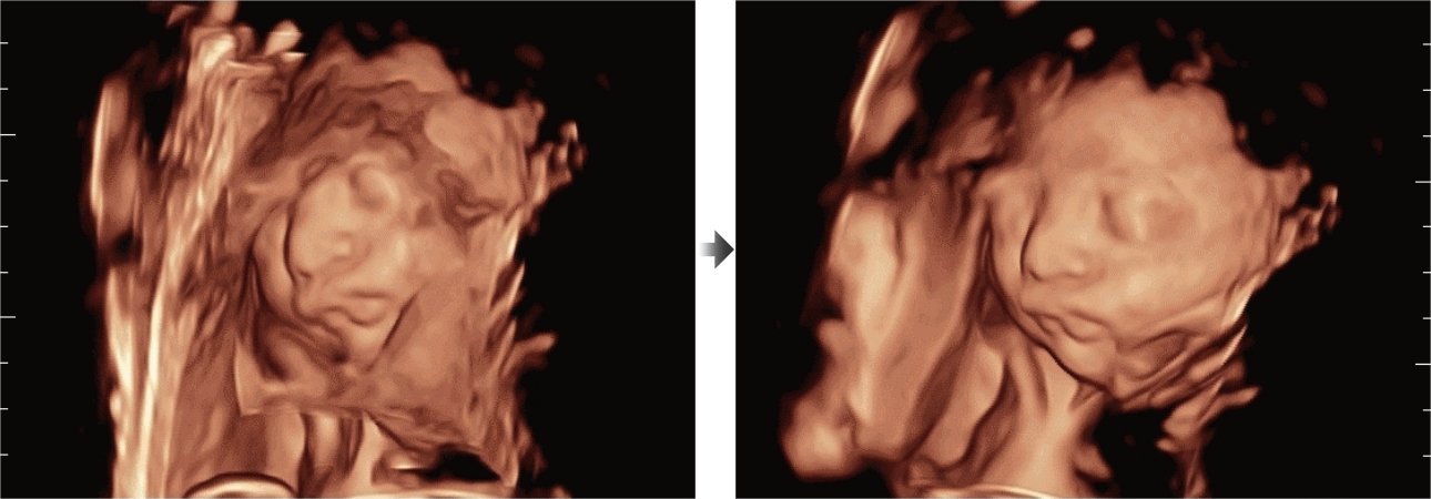 Mindray Resona 7 Premium Ultrasound System with ZONE Sonography Technology and Advanced Imaging Features