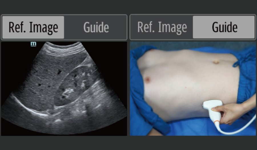 Mindray BeneHeart D60 Defibrillator Monitor with Smart Touch Technology and Point-of-Care Ultrasound