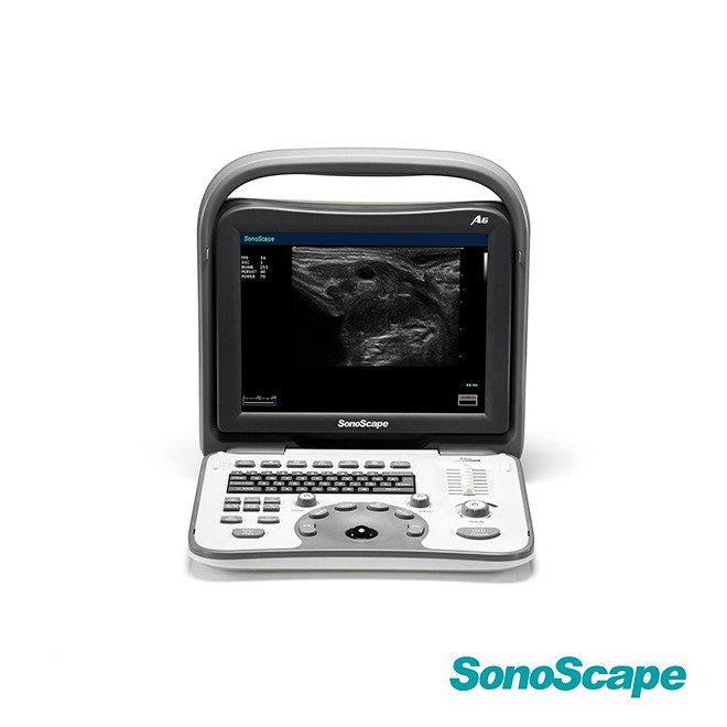 Ultrasound SonoScape A6