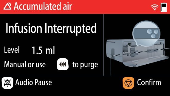 BeneFusion 5 Series Infusion Pump System - Smart, Accurate, User-Friendly Medical Device