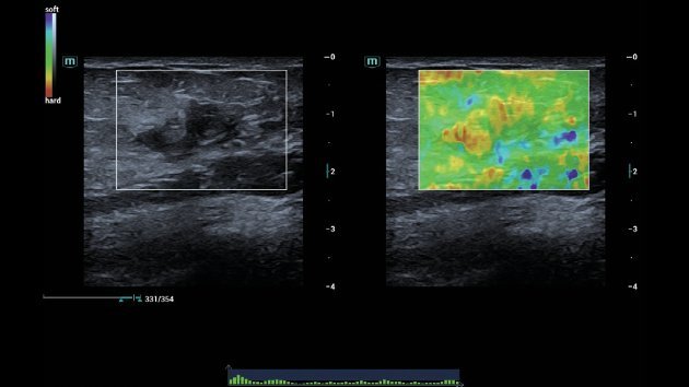 Consona N6 Comprehensive Imaging Solutions - Advanced Ultrasound Technology for General Imaging, Women's Health, and Cardiovascular Applications