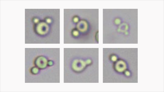 Automated Urinalysis System EU-5600 Pro/5300 Pro - Advanced Laboratory Analysis with 2K Imaging and Enhanced Efficiency