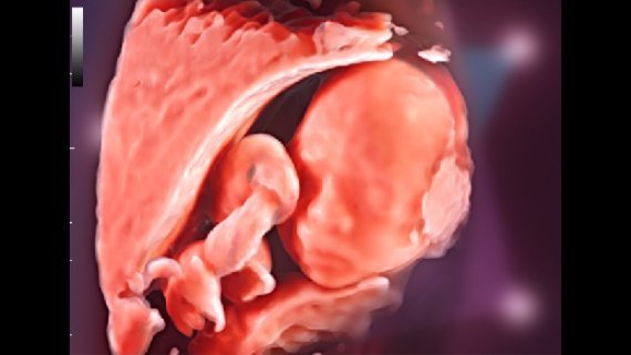 Mindray DC-70 Ultrasound System with X-Insight Technology for Precision Imaging