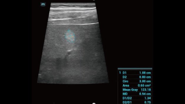 Consona N7 Comprehensive Imaging Ultrasound Device