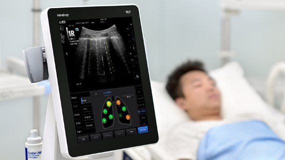 Mindray TE7 ACE Ultrasound Machine for Anesthesia, Critical Care, and Emergency Applications