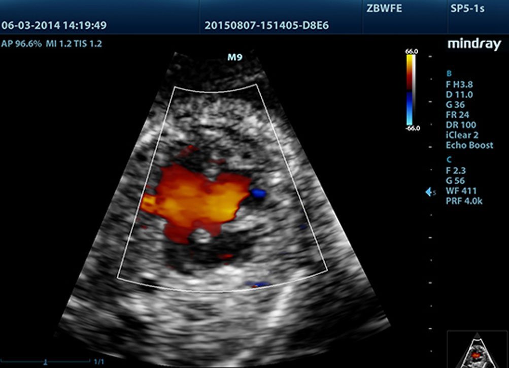 Mindray M9 Portable Ultrasound System - Advanced Imaging and Diagnostic Solutions