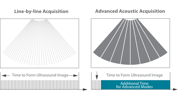 MX7 Ultrasound System - Advanced Mobile Imaging Solution