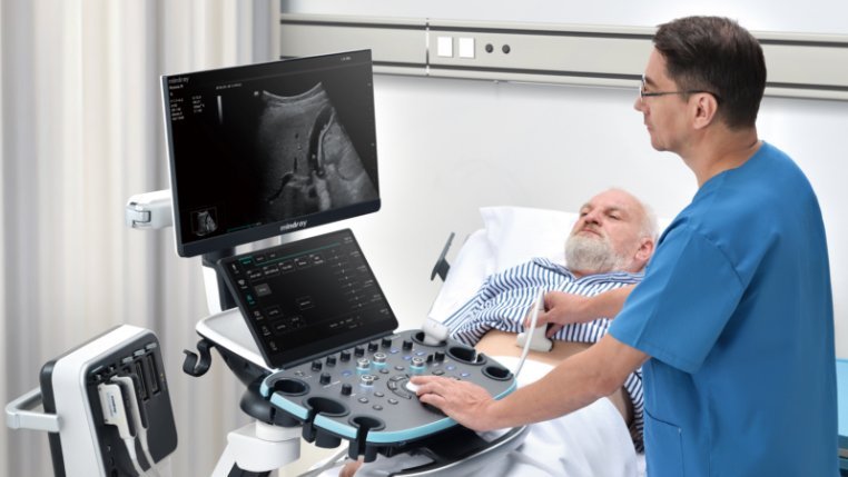 Resona I9 Diagnostic Ultrasound System - Advanced Imaging Technology for Clinical Solutions