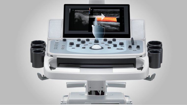 Mindray DC-60 ECHO Ultrasound System with X-Insight Technology for Enhanced Imaging and Clinical Efficiency
