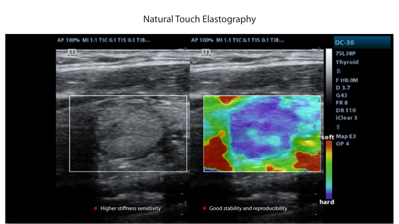 DC-30 FullHD Ultrasound System for Enhanced Diagnostic Imaging