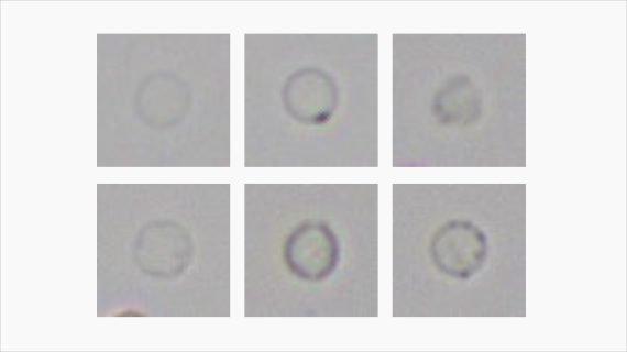 Automated Urinalysis System EU-5600 Pro/5300 Pro - Advanced Laboratory Analysis with 2K Imaging and Enhanced Efficiency