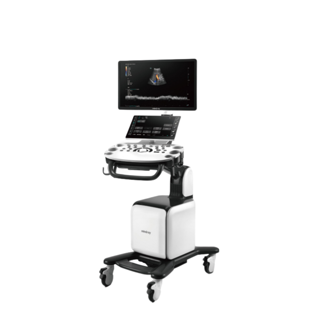 Consona N6 Comprehensive Imaging Solutions - Advanced Ultrasound Technology for General Imaging, Women's Health, and Cardiovascular Applications