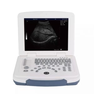 First-Class Digital Imaging B/W Ultrasound Machine MEK-580