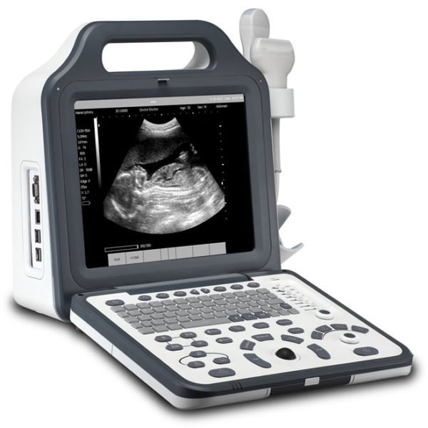 Handheld Wireless Mini B & Color Doppler Ultrasound Scanner NEUPU51