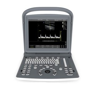 Musculoskeletal Ultrasound ECO2