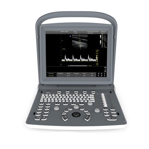 Musculoskeletal Ultrasound ECO2
