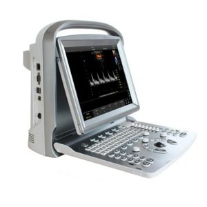 Abdominal Doppler Ultrasound ECO5