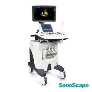 Endovaginal Ultrasound SonoScape S30
