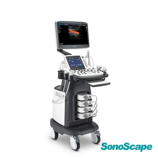 Doppler Carotidian Ultrasound SonoScape S22