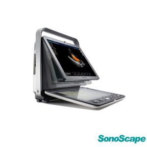 Color Doppler Ultrasound SonoScape S9