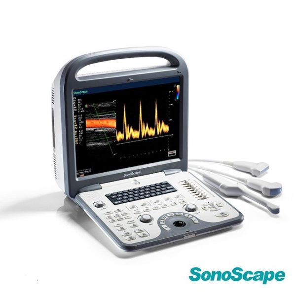 4D Ultrasound SonoScape S6