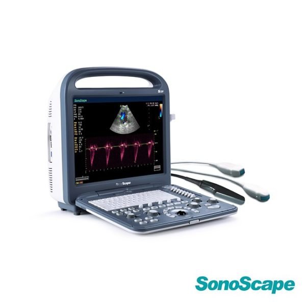 Ultrasound SonoScape S2