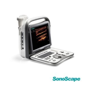 Ultrasound SonoScape A6
