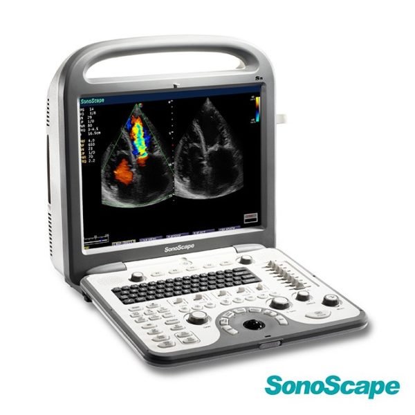 4D Cardiac Stress Color Doppler Ultrasound SonoScape S8